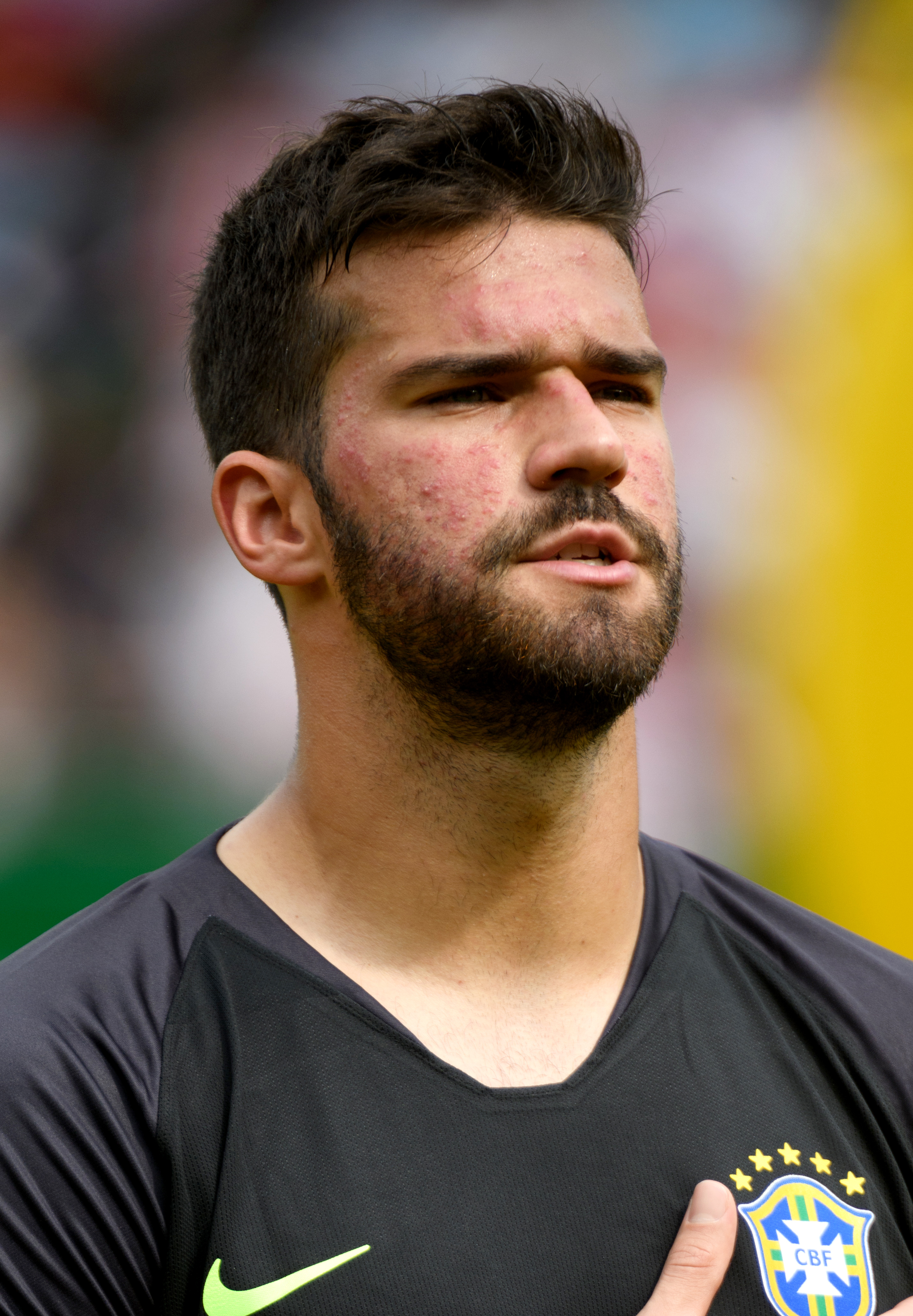 Alisson